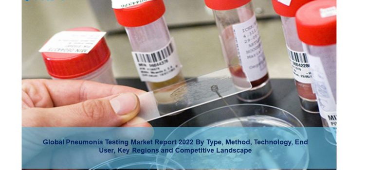 Pneumonia Testing Market 2022-27 | Growth, Share Statistics