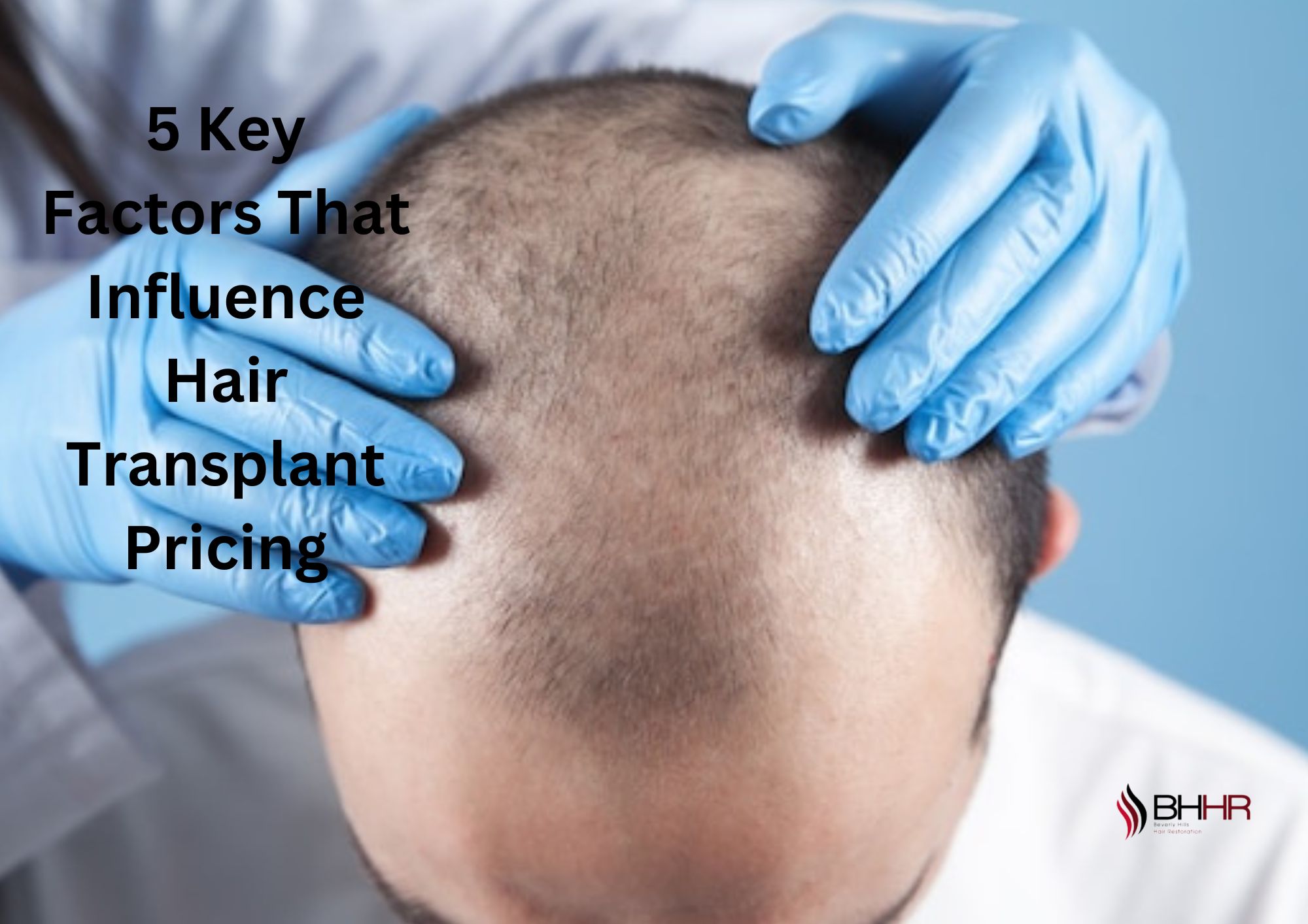 hair transplant price